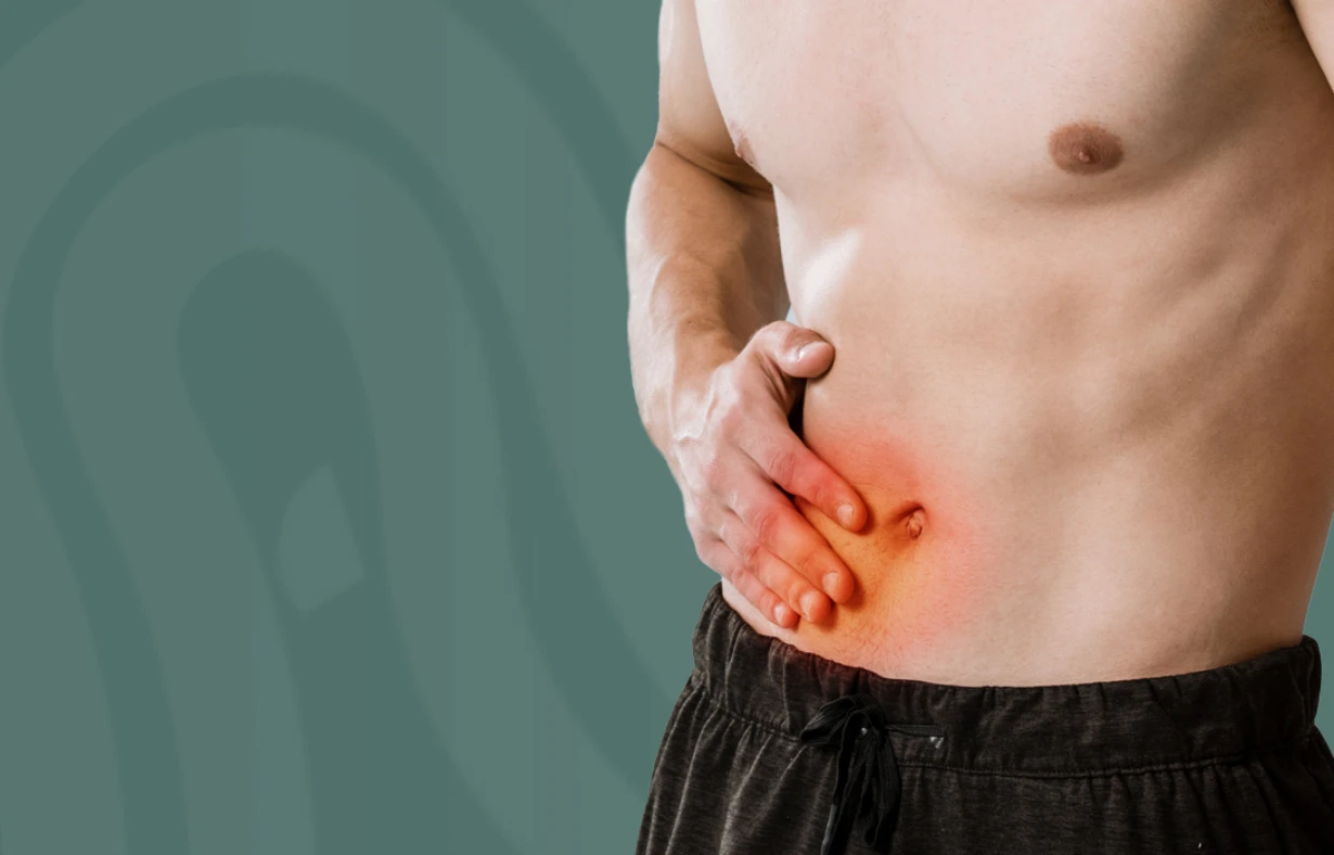 Hernia – Types, Symptoms, Causes & Laparoscopic Treatment