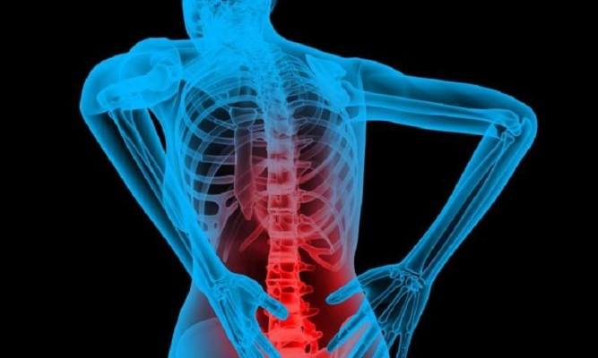 Bone Tuberculosis